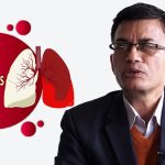 नेपालमा क्षयरोगका कारण वार्षिक १६ को हजार मृत्यु, न्यूनीकरणमा स्रोतको अभाव