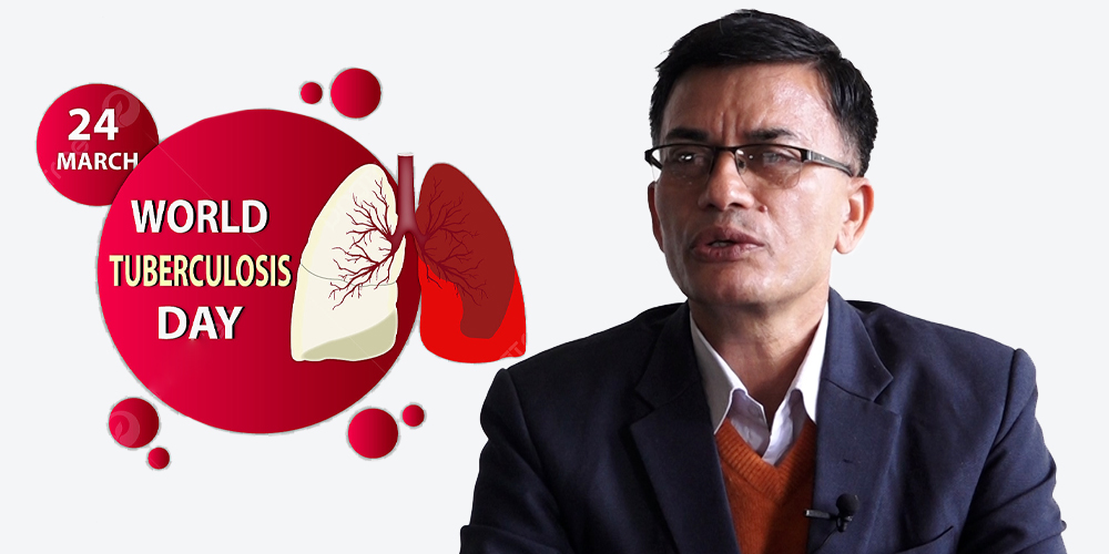 नेपालमा क्षयरोगका कारण वार्षिक १६ को हजार मृत्यु, न्यूनीकरणमा स्रोतको अभाव